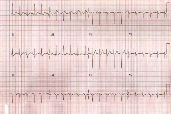 Kra43cc